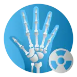 Artharitis